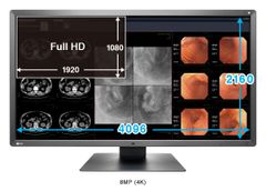  Màn Hình Y Tế EIZO RadiForce® MX315W 