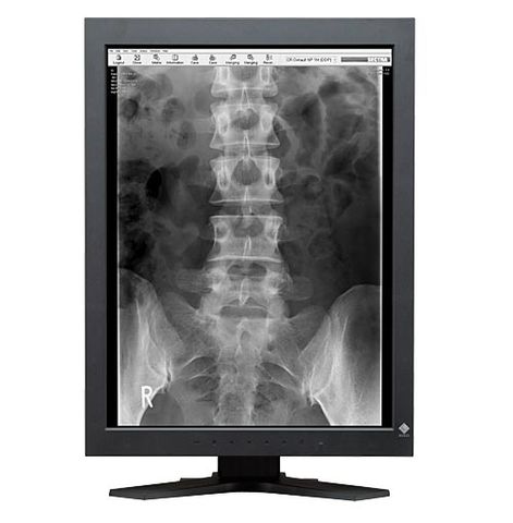 Màn Hình Y Tế EIZO RadiForce GS220
