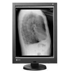  Màn Hình Y Tế EIZO RadiForce GX340 