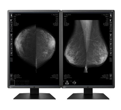 Màn Hình Y Tế EIZO RadiForce GX550