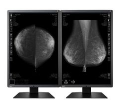  Màn Hình Y Tế EIZO RadiForce GX550 