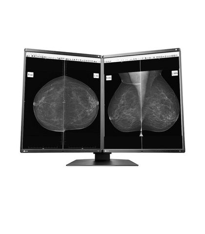 Màn Hình Y Tế EIZO RadiForce GX560