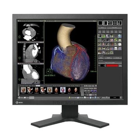 Màn Hình Y Tế EIZO RadiForce MX210