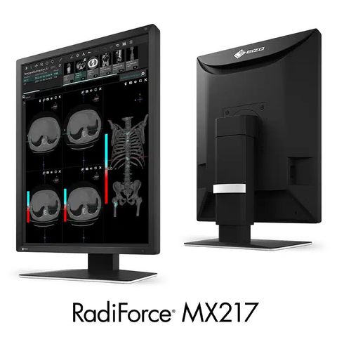 Màn Hình Y Tế EIZO RadiForce MX217