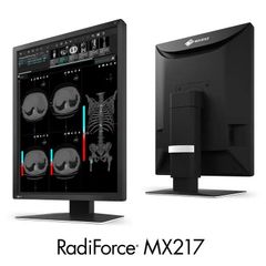  Màn Hình Y Tế EIZO RadiForce MX217 