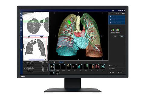 Màn Hình Y Tế EIZO RadiForce MX243W