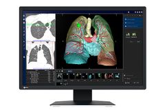  Màn Hình Y Tế EIZO RadiForce MX243W 