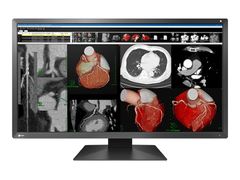  Màn Hình Y Tế EIZO RadiForce MX317W 