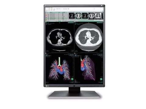 Màn Hình Y Tế EIZO RadiForce RS340