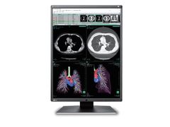  Màn Hình Y Tế EIZO RadiForce RS340 