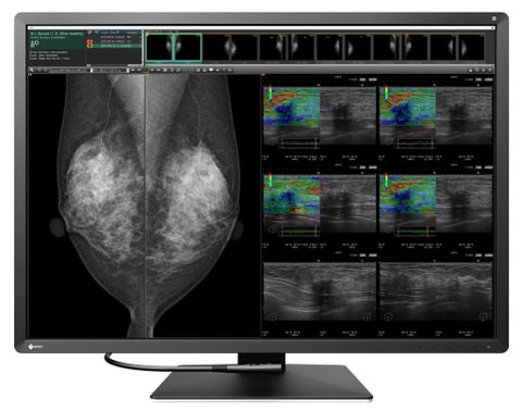 Màn Hình Y Tế EIZO RadiForce RX1270