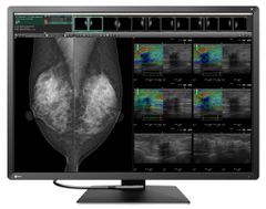  Màn Hình Y Tế EIZO RadiForce RX1270 