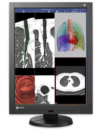 Màn Hình Y Tế EIZO RadiForce RX240