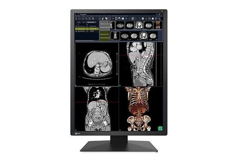Màn Hình Y Tế EIZO RadiForce RX270