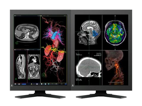 Màn Hình Y Tế Eizo Radiforce RX320