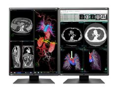 Màn Hình Y Tế Eizo RadiForce RX360 