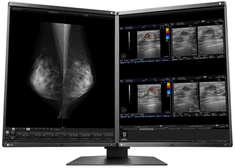 Màn Hình Y Tế EIZO RadiForce RX560