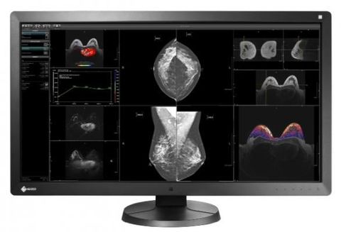 Màn Hình Y Tế EIZO RadiForce RX850
