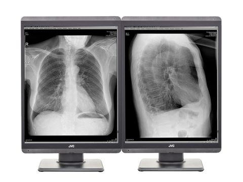 Màn Hình Y Tế JVC Totoku MS-S21