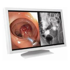  Màn hình y tế Kraft Surgicals Private Limited MHSD-2410 