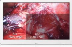  Màn hình y tế LG 27HK510S-W 27 Full HD 