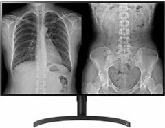  Màn Hình Y Tế LG 32HL512D 