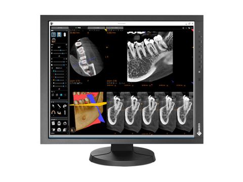 Màn Hình Y Tế Eizo RadiForce MX215