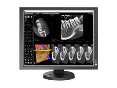  Màn Hình Y Tế Eizo RadiForce MX215 