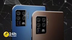  Giá chỉ thế này mà Nokia 7610 5G lại được dự đoán có nhiều thông số khủng như chip Snapdragon 888, màn hình 120 Hz... 