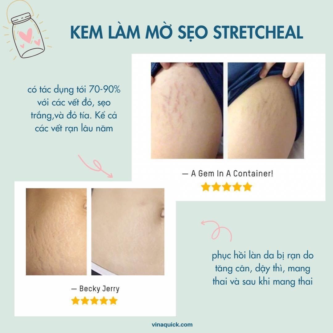  Kem trị rạn da stretcheal, tuýp 180ml 