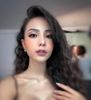  Đầy hõm má, thái dương 
