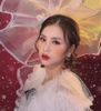  Tiêm gọn góc hàm 