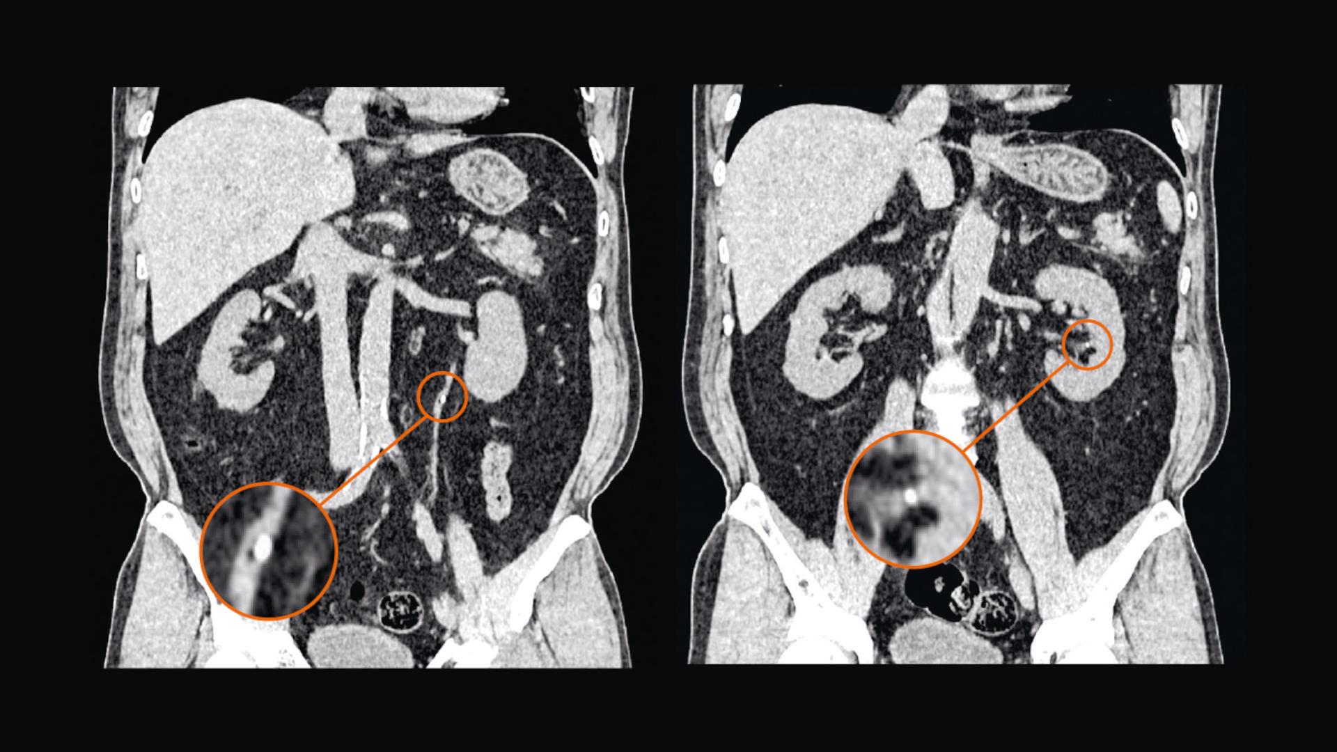 Phòng khám Đa khoa Phương Nam trang bị CT SOMATOM 32 lát cắt
