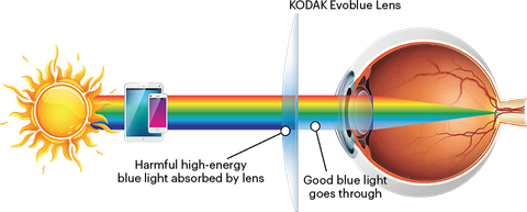 Tròng Kính Đổi Màu Kodak 1.60 EvoBlue Lens Chống Ánh Sáng Xanh 