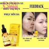 Serum Trị Mụn Collagen X3 - Mỹ Phẩm Đông Anh.