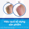 Kem dưỡng da chân khô, nứt nẻ O’Keeffe’s Healthy Feet Cream 91g (Bill Anh)