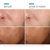 Tinh chất dưỡng Skinceuticals Phloretin CF_Mini 4ml (Bill Anh)