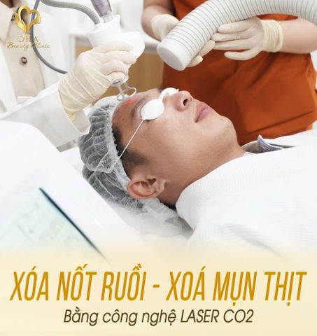  XÓA NỐT RUỒI 