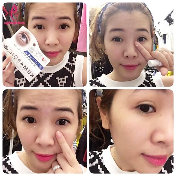 Cách sử dụng kem trị thâm quầng mắt Kumargic Eye