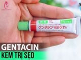 Kem trị sẹo GENTACIN Nhật Bản Lồi Lõm tốt nhất