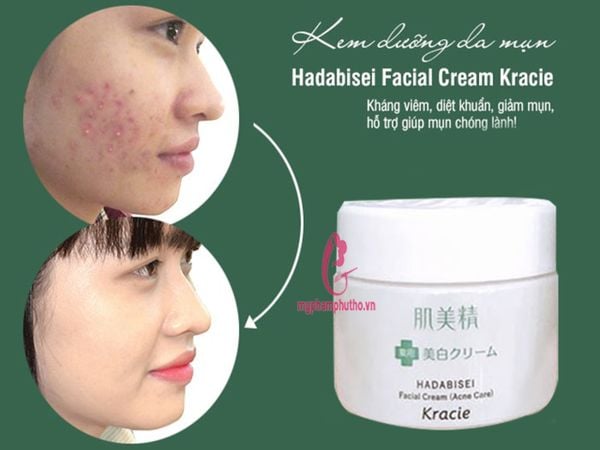 review Kem dưỡng trị mụn Kracie Hadabisei Nhật Bản