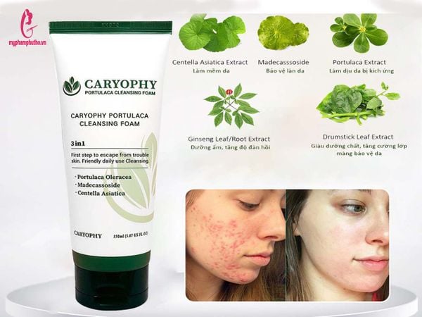 sữa rửa mặt caryophy