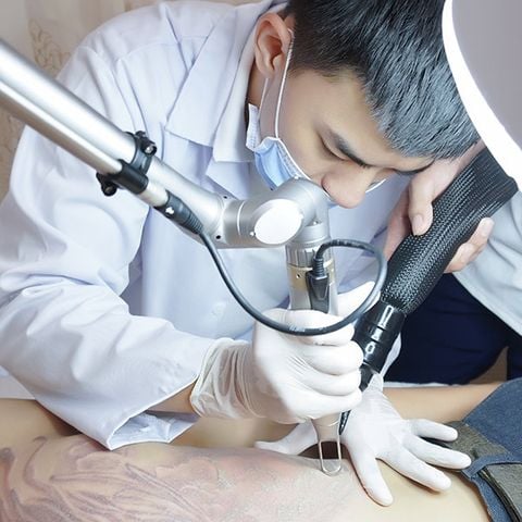 Voucher Xóa Xăm 1 Lần Bằng Công Nghệ Cao Tại Beryl Beauty