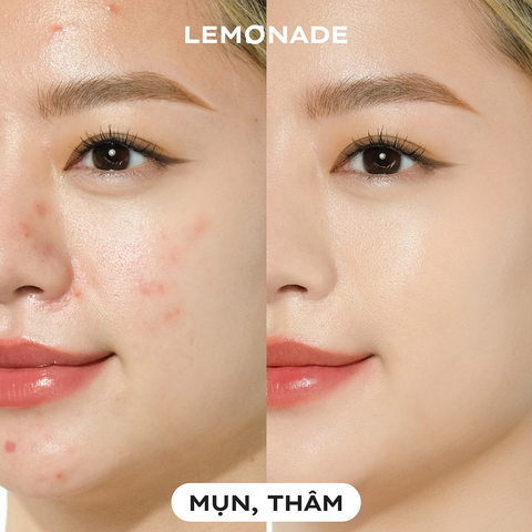  COMBO LEMONADE CHE KHUYẾT ĐIỂM MATTE ADDICT CONCEALER &  KẸP MI CURLER 