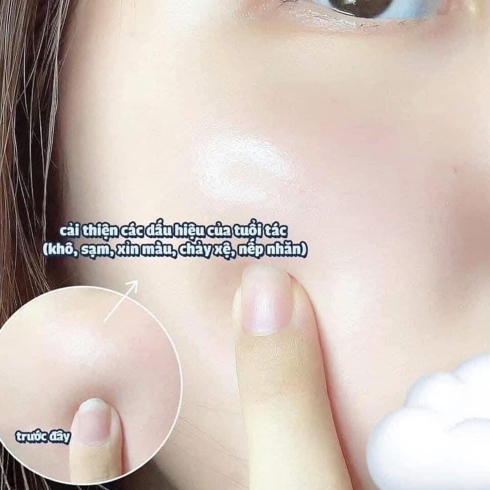 Mặt Nạ Cấp Ẩm DERM ALL MATRIX ALL IN ONE - 25g