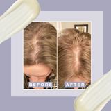 Serum mọc tóc chống rụng tóc đặc trị Grow Gorgeous Hair Density Serum Intense