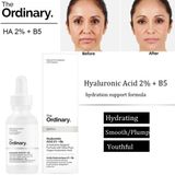 Serum cấp ẩm The Ordinary Hyaluronic Acid 2% + B5