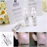 Serum dưỡng trắng mờ nám Kiehl’s Clearly Corrective Dark Spot Solution