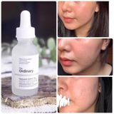 Serum cấp ẩm The Ordinary Hyaluronic Acid 2% + B5