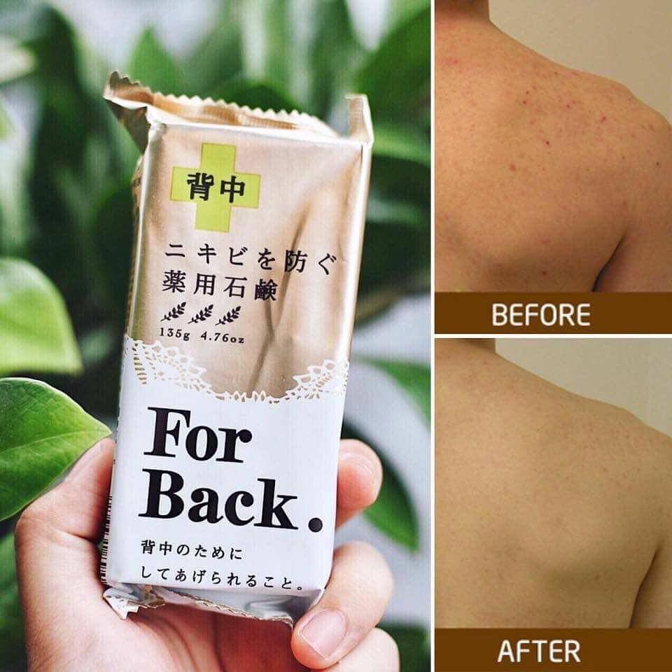 Xà phòng trị mụn lưng For Back Medicated Soap Pelican-4976631894225 – Smile  JP Mart - Hệ thống sỉ & lẻ hàng nội địa Nhật Bản